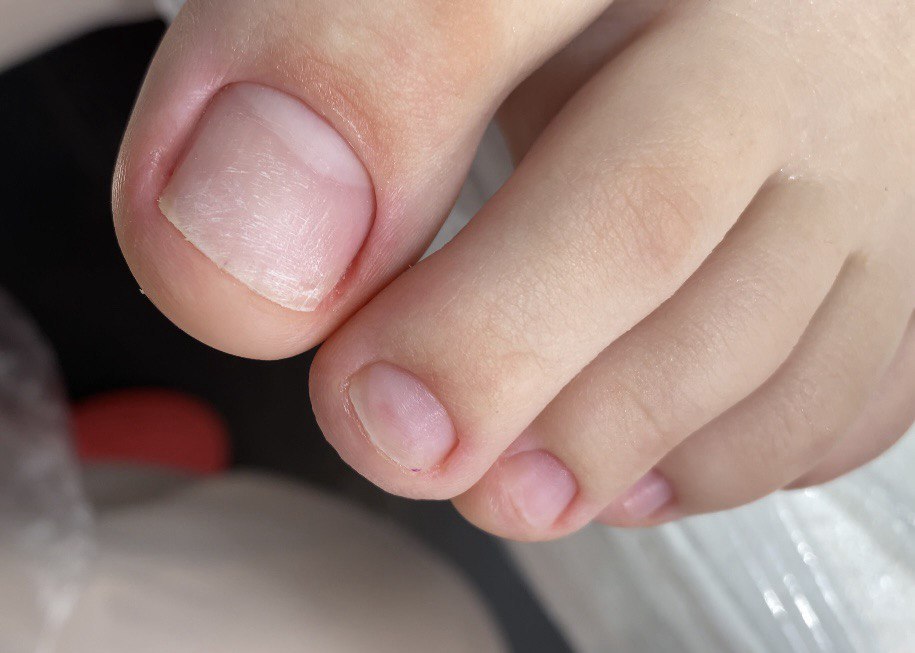 Natural pedicure showing clean, unpolished toenails with smooth nail plates and neat cuticle care.